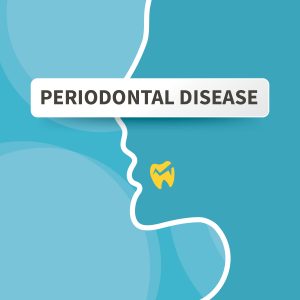 All-Locations-Infographic-Posts-4-300×300